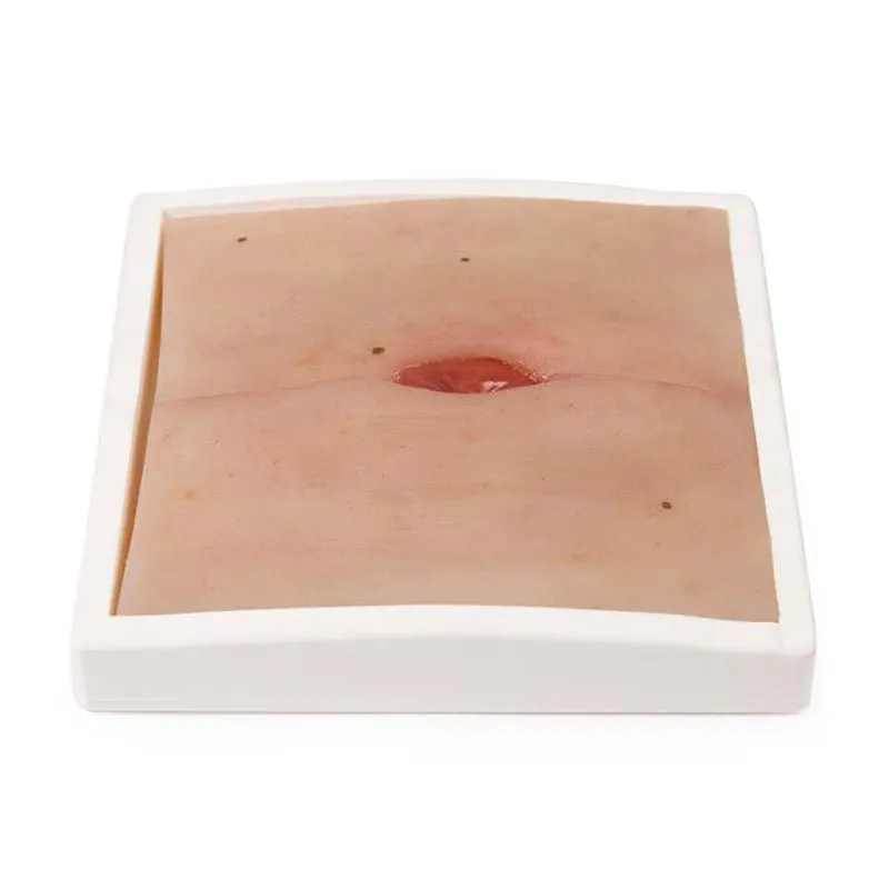 Wound Moulage Colostoma in Abdominal Crease, Incl. Stand